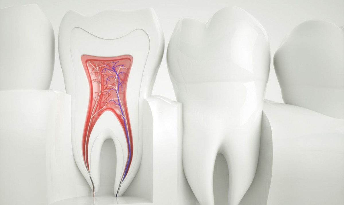 Lechenie-kornevyh-kanalov-zubov
